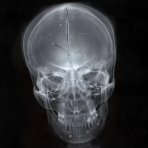 imagen de Hijos de la Ruina en directo