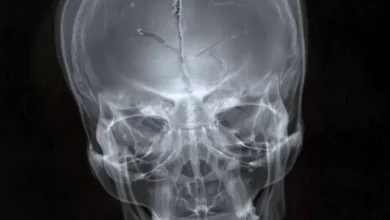 imagen de Hijos de la Ruina en directo