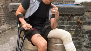 Yungblud mantendrá su gira mundial sobre los escenarios pese a sufrir una fractura de pierna